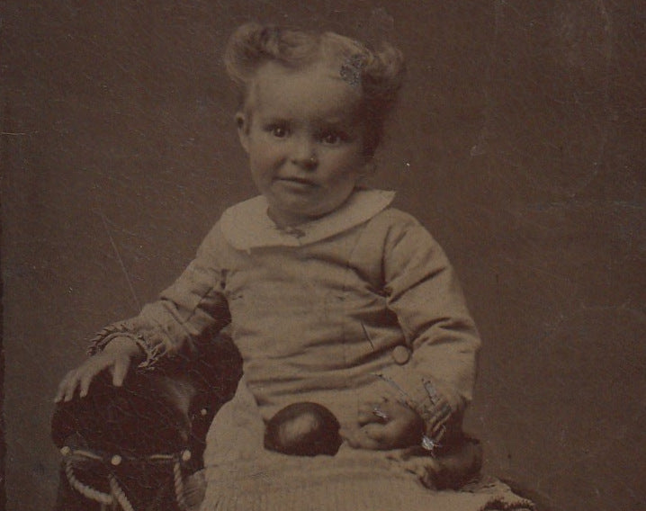 Deformed Hand - Symbrachydactyly - Victorian Child - Tintype Photo, c. 1800s Close Up