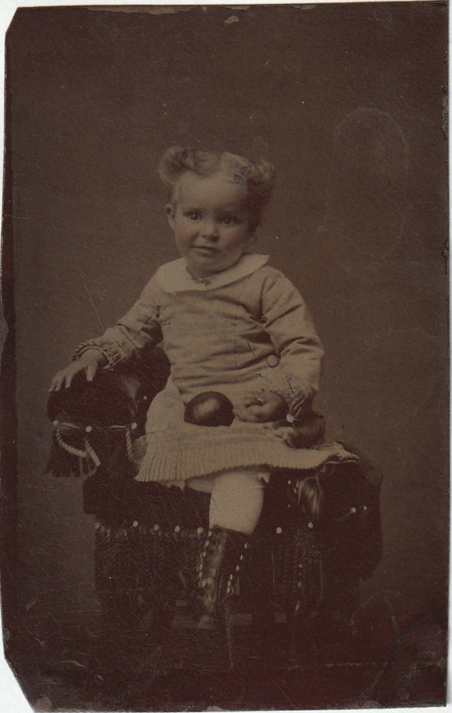 Deformed Hand - Symbrachydactyly - Victorian Child - Tintype Photo, c. 1800s