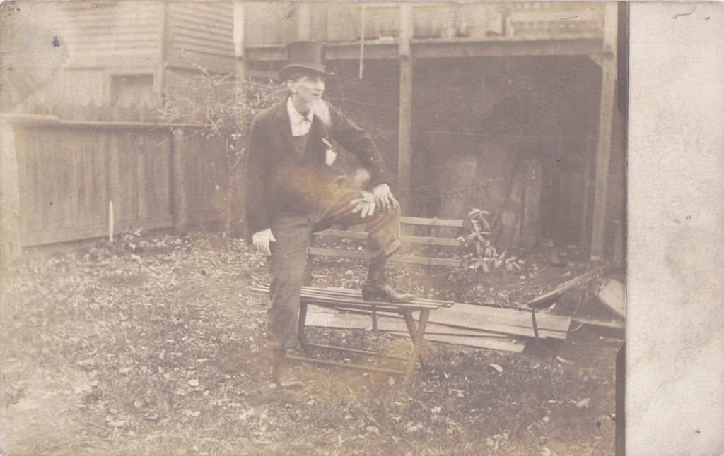 Brachydactyly- 1900s Antique Photograph- Edwardian Man- Fake Beard Top Hat- Hand Abnormality- Real Photo Postcard RPPC- Paper Ephemera