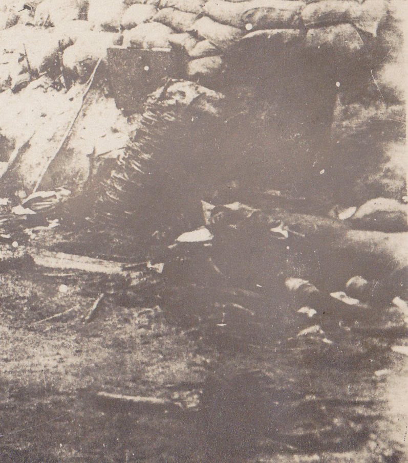 Soissons Front Casualties- 1910s Antique Photograph- WWI Battlefield- Trench Warfare- Eyewitness History- RPPC- July 1918